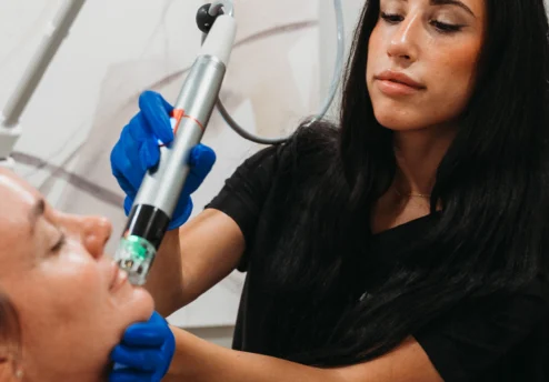 Microneedling