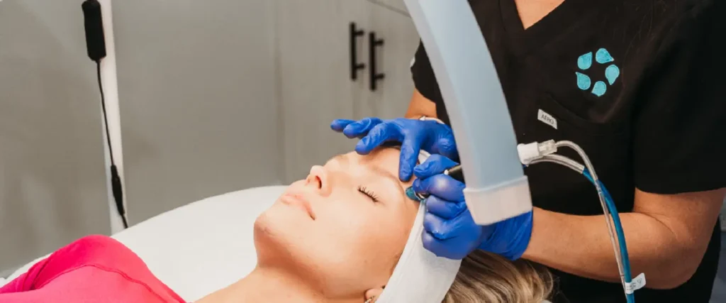 Microneedling