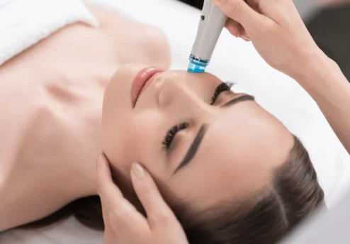 Microneedling